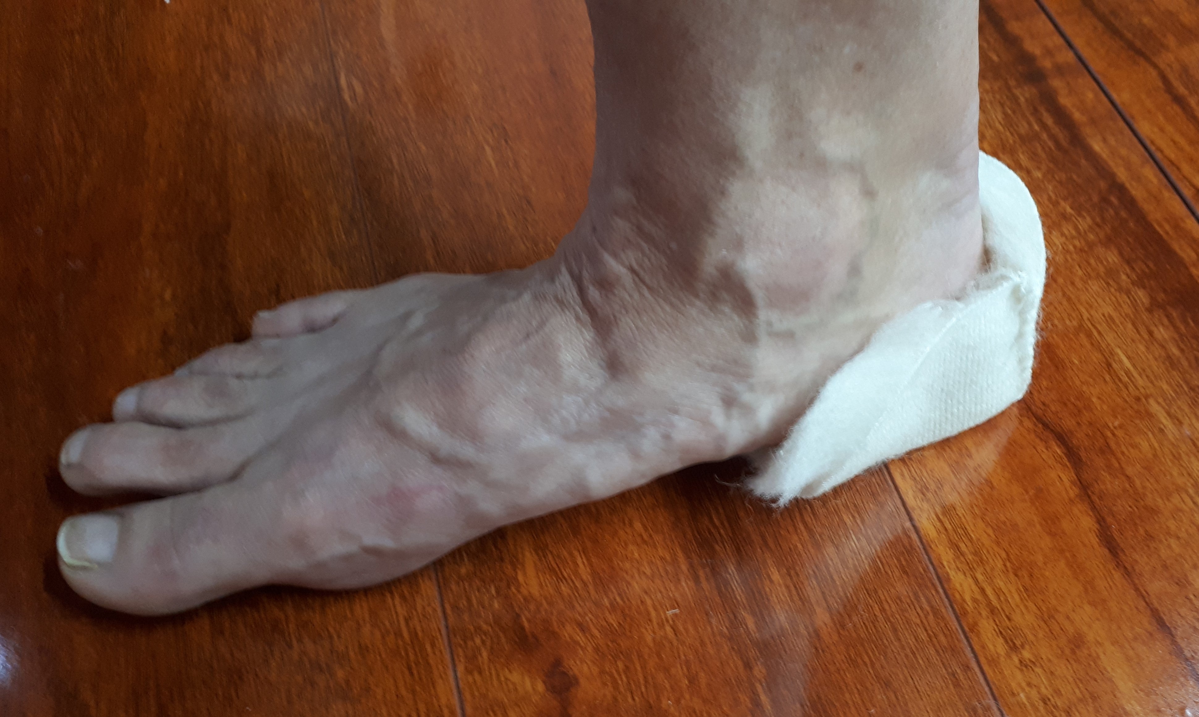 Wound Care Heel Package